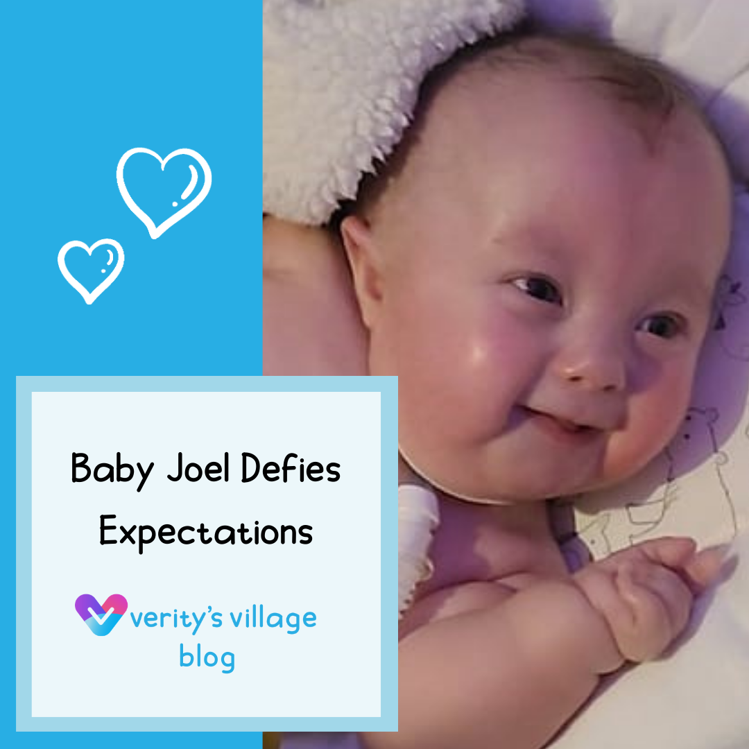 Baby Joel Defies Expectations