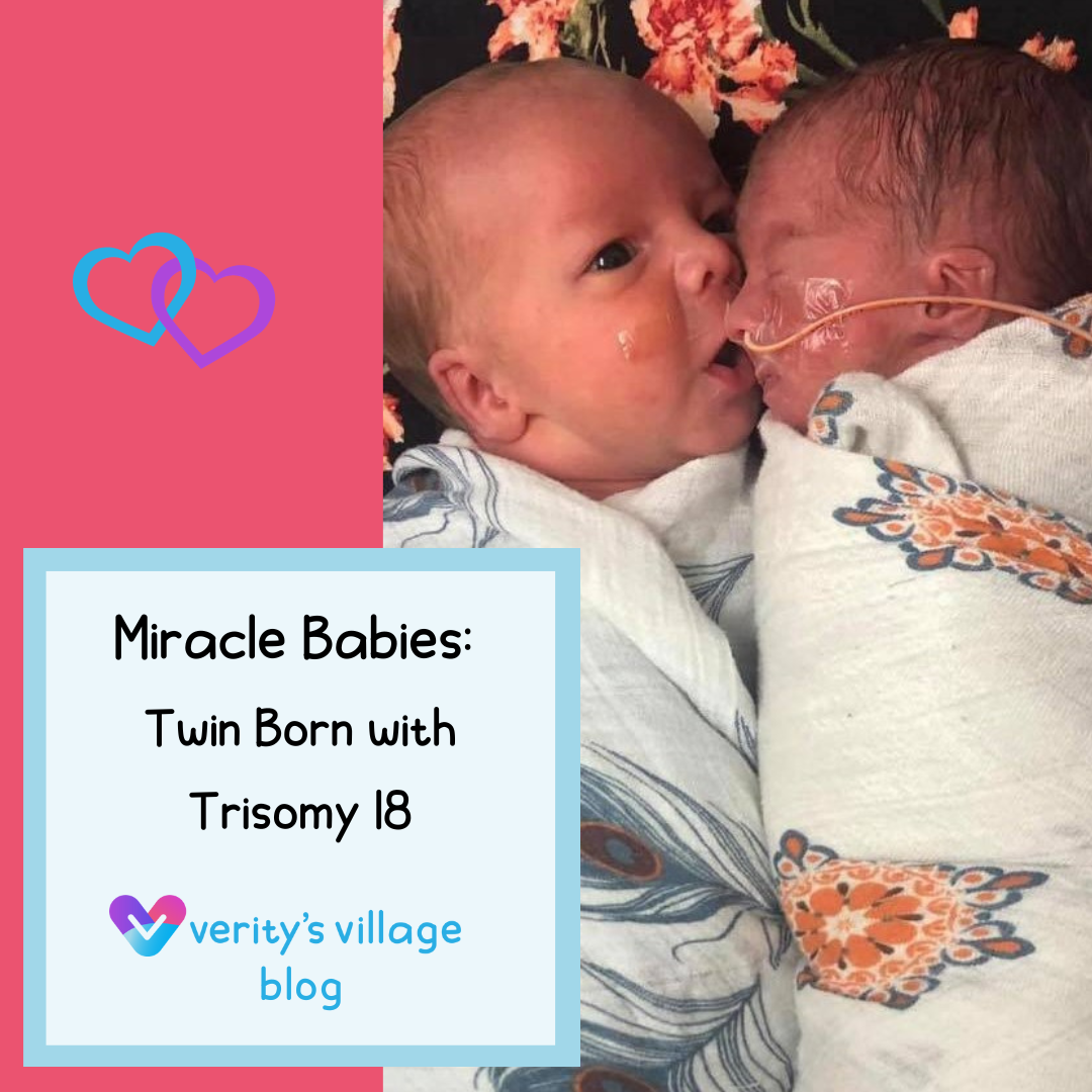 Miracle Babies: Twin Born with Trisomy 18