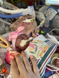 baby connected to life support machines